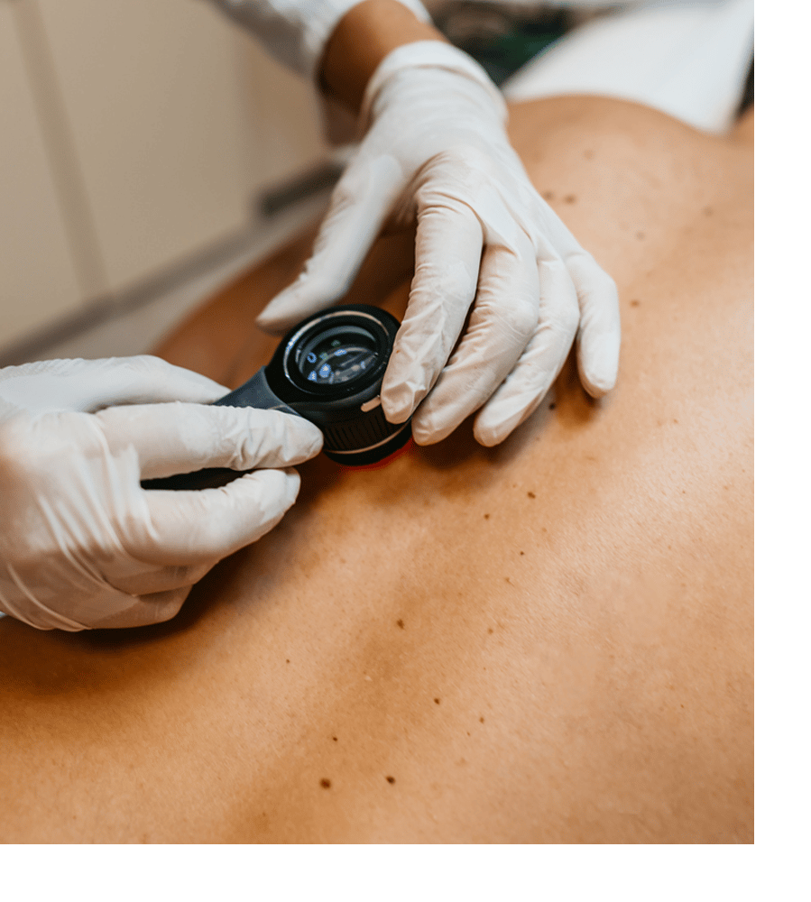 a close up of a hand